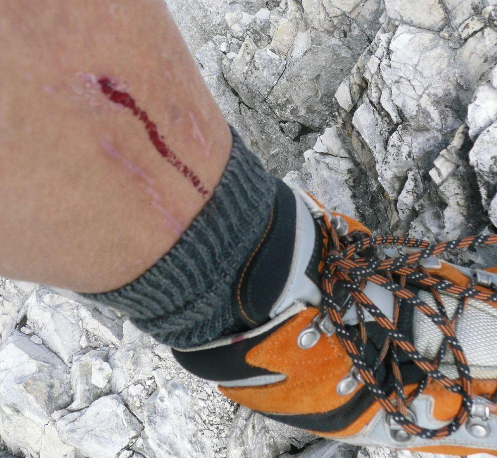 Große Verletzung :-)